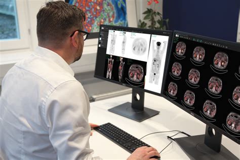 hermes processing|hermes molecular imaging software.